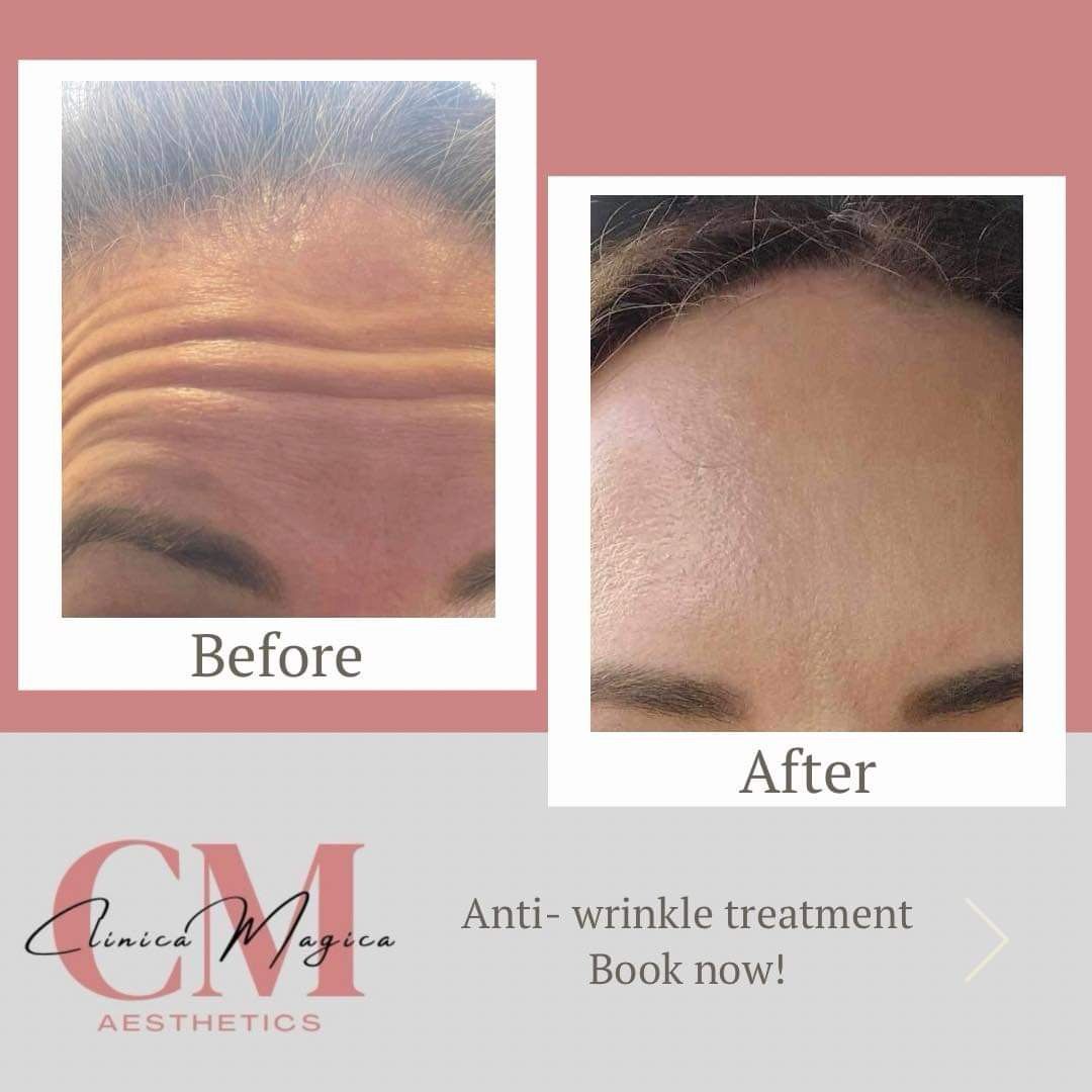 Clinica Magica Anti Wrinkle Treatment Book Now